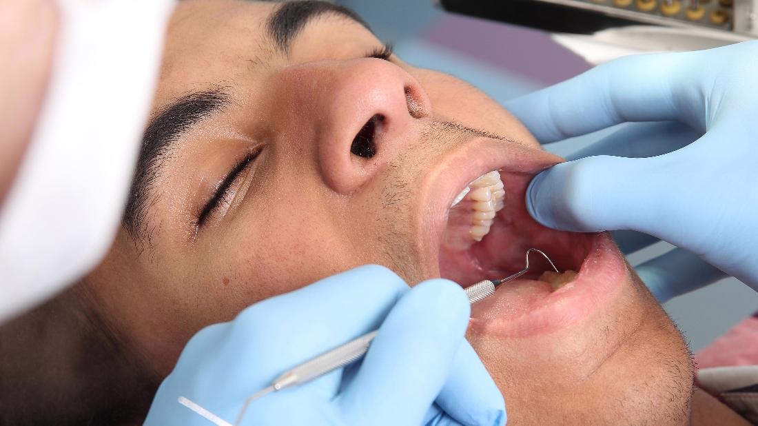 How A Potato Chip Found Oral Cancer From Springs Family Dental